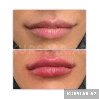 Dodaq dolğusu təlimi Dodaq dolğusu təlimi