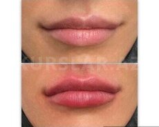 Dodaq dolğusu təlimi